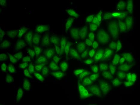 ATXN1 / SCA1 Antibody