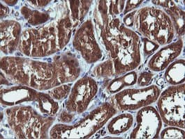 PIK3C2B Antibody (clone OTI3B1)