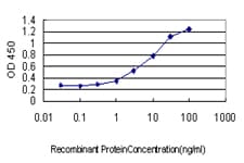 Monoclonal Mouse anti-Human UCHL3 Antibody (clone 4E9, WB)