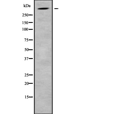 ADGRG4 / GPR112 Antibody