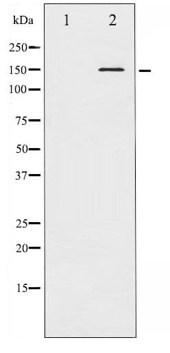 Polyclonal Rabbit anti-Human c-Met Antibody (phospho-Tyr1349, WB)