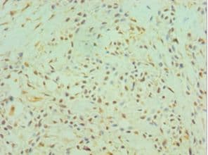 Polyclonal Rabbit anti-Human CTSK / Cathepsin K Antibody (aa115-329, IHC, WB)