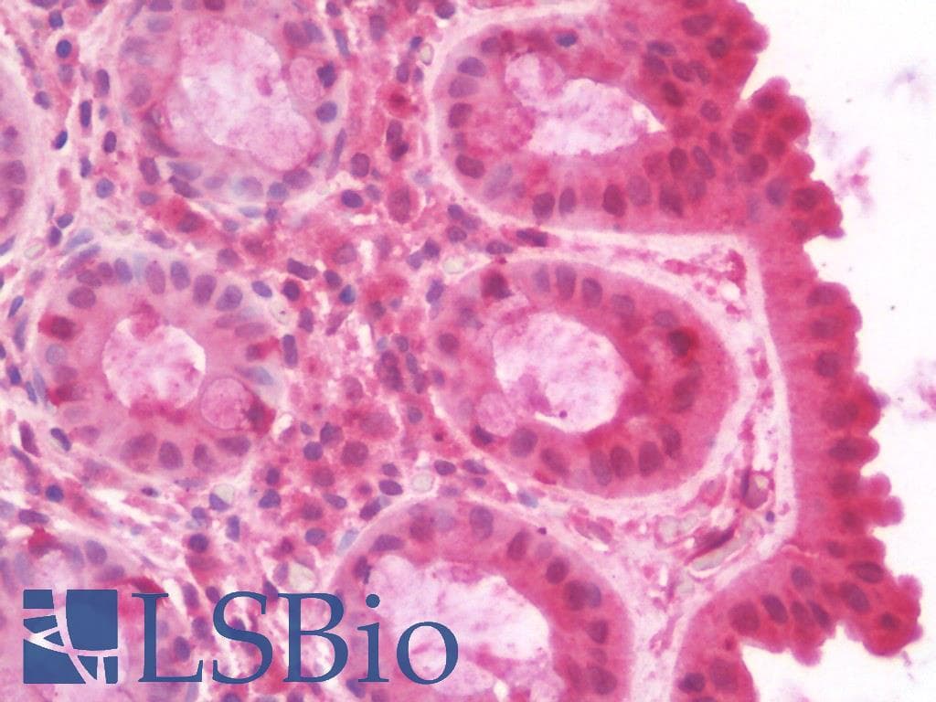 IHC-plus™ STX4 / Syntaxin 4 Antibody (aa1-297)
