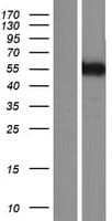 KATNA1 Protein (Over-Expression Lysate Myc-DDK (Flag))