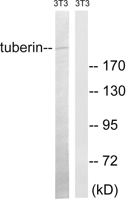 Polyclonal Rabbit anti-Human Tuberin / TSC2 Antibody (aa947-996, WB)
