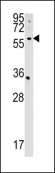 CDS2 Antibody (aa138-165)
