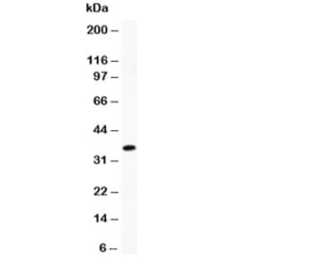 MPO / Myeloperoxidase Antibody (aa406-745)
