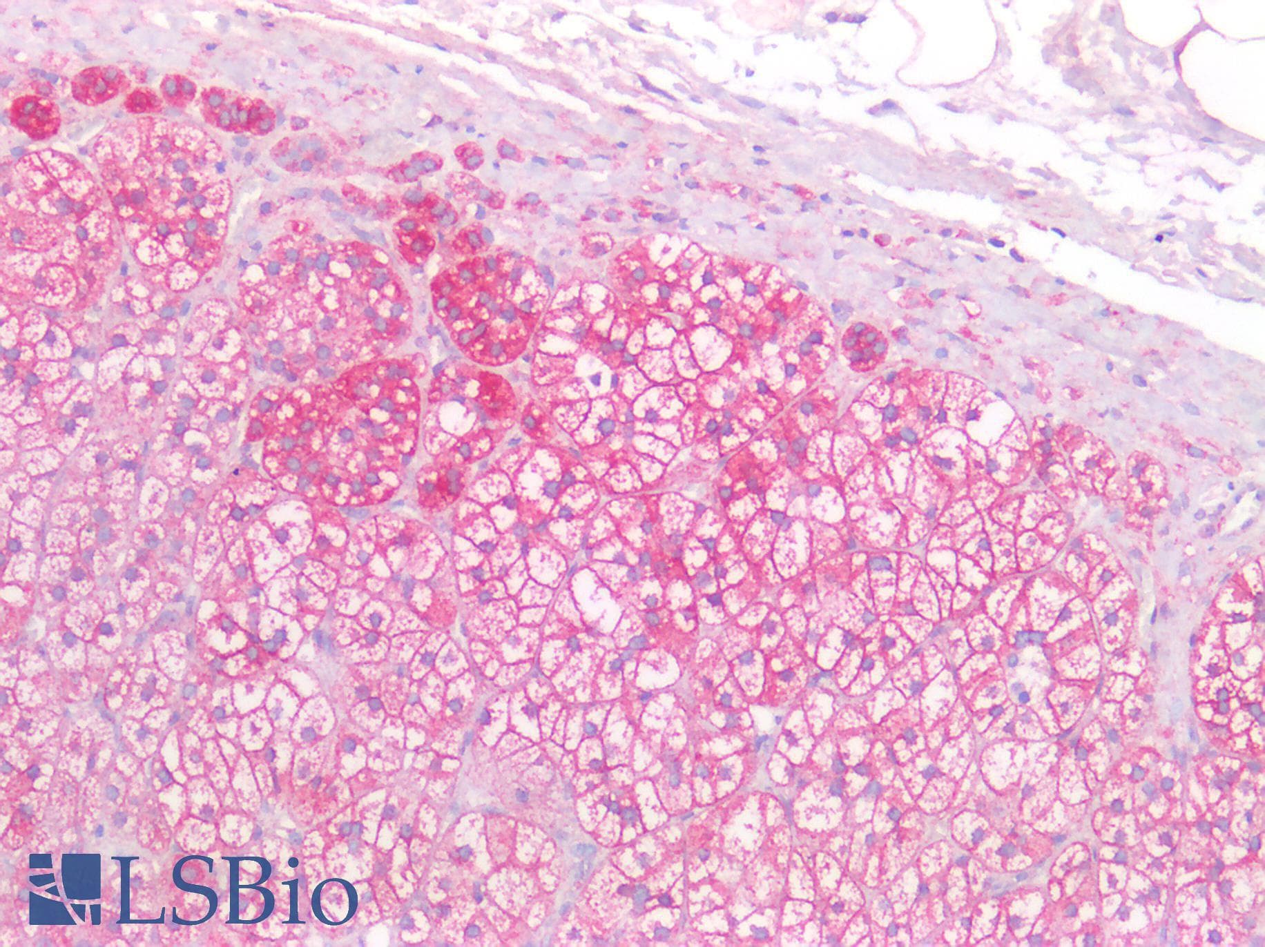 PathPlus™ LDLR / LDL Receptor Antibody (aa810-860)