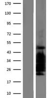 CITED2 Protein (Over-Expression Lysate Myc-DDK (Flag))