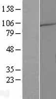 WDR78 Protein (Over-Expression Lysate Myc-DDK (Flag))