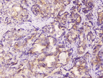EML4 Antibody