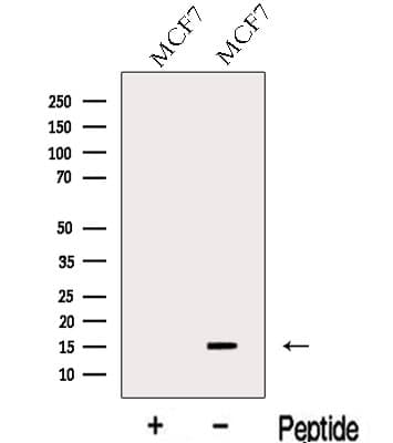Polyclonal Rabbit anti-Human LSM4 Antibody (WB)