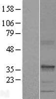 SEC22C Protein (Over-Expression Lysate Myc-DDK (Flag))