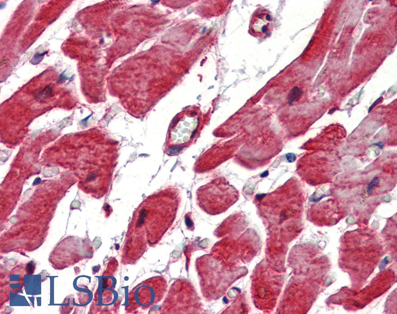 IHC-plus™ HSPB1 / HSP27 Antibody