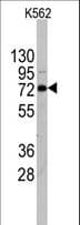 Polyclonal Rabbit anti-Human DDX4 / VASA Antibody (aa554-583, IHC, WB)