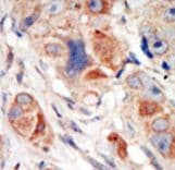 PIK3CD / PI3K Delta Antibody (aa687-717)