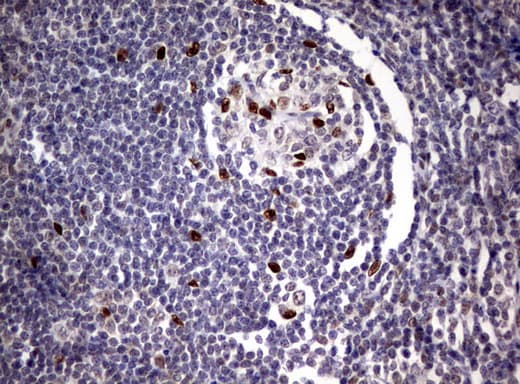 ZSCAN18 / ZNF447 Antibody (clone UMAB113)