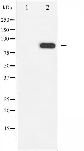 CHUK / IKKA / IKK Alpha Antibody (phospho-Thr23)
