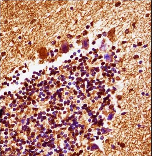 Polyclonal Rabbit anti-Mouse MAP2K4 / MKK4 Antibody (aa259-287, IHC, WB)