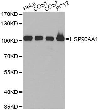 Polyclonal Rabbit anti-Human HSP90AA1 / Hsp90 Alpha A1 Antibody (WB)