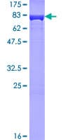 Human HSPD1 / HSP60 Protein (Recombinant GST)