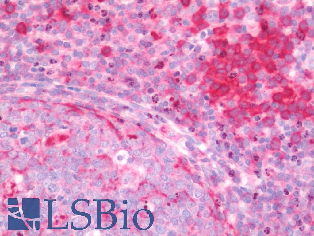 IHC-plus™ TNM / Teneurin-1 Antibody