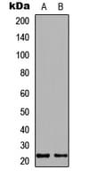 Polyclonal Rabbit anti-Human IGF1 Antibody (Internal, WB)
