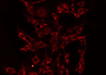 CD39 Antibody