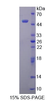 Human TSPO / PBR Protein (Recombinant His-GST)