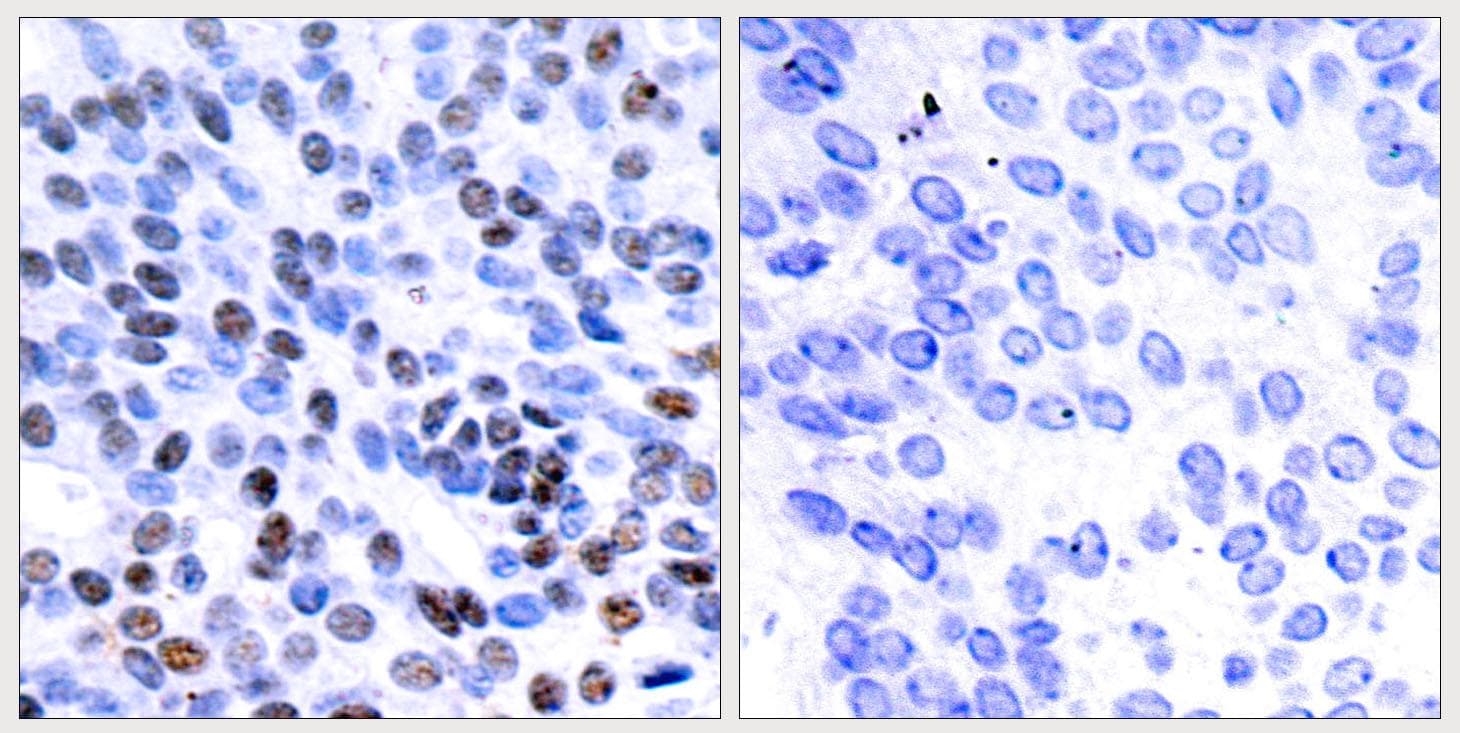 JUNB / JUN-B Antibody (p259)