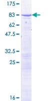 Human GPATCH2 Protein (Recombinant GST)