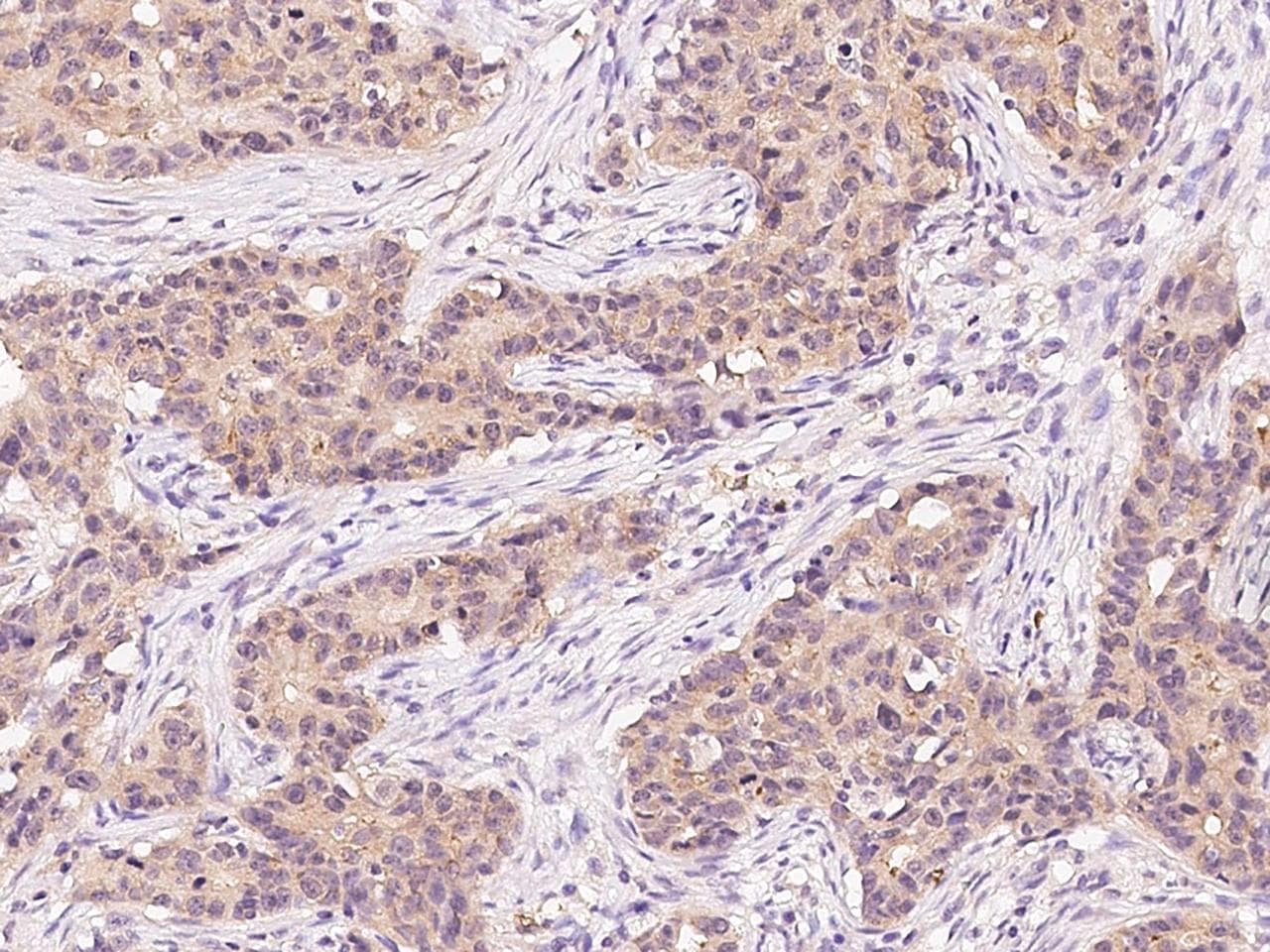 CHUK / IKKA / IKK Alpha Antibody (Preservative Free)
