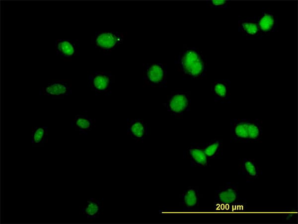 IHC-plus™ Monoclonal Mouse anti-Human ACTN4 Antibody (clone 4D10, IHC, IF, WB)