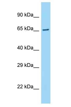 Polyclonal Rabbit anti-Human ARMCX5 Antibody (aa504-553, WB)