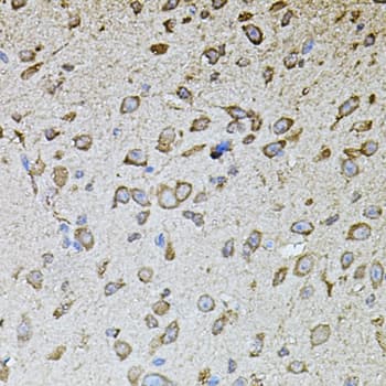 MPO / Myeloperoxidase Antibody