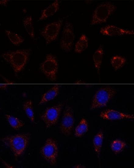 TBRG4 Antibody