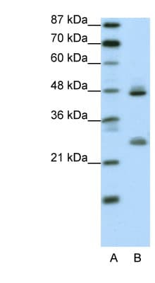 KLF6 Antibody (aa155-204)