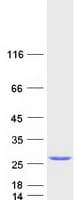 Human RAB2A / RAB2 Protein (Recombinant Myc-DDK (Flag))