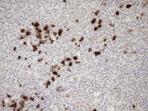 Zfp105 / ZNF35 Antibody (aa1-258, clone OTI4D5)