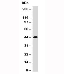 EPCAM Antibody (clone EPM17-1)