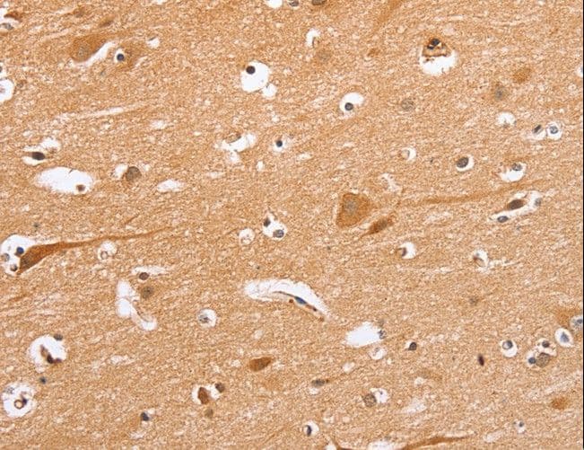 BLNK Antibody