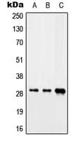SARNP / Hcc-1 / CIP29 Antibody (C-Terminus)