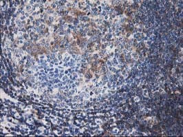 Monoclonal Mouse anti-Human CNN2 Antibody (clone OTI2B5, IHC, IF, WB)