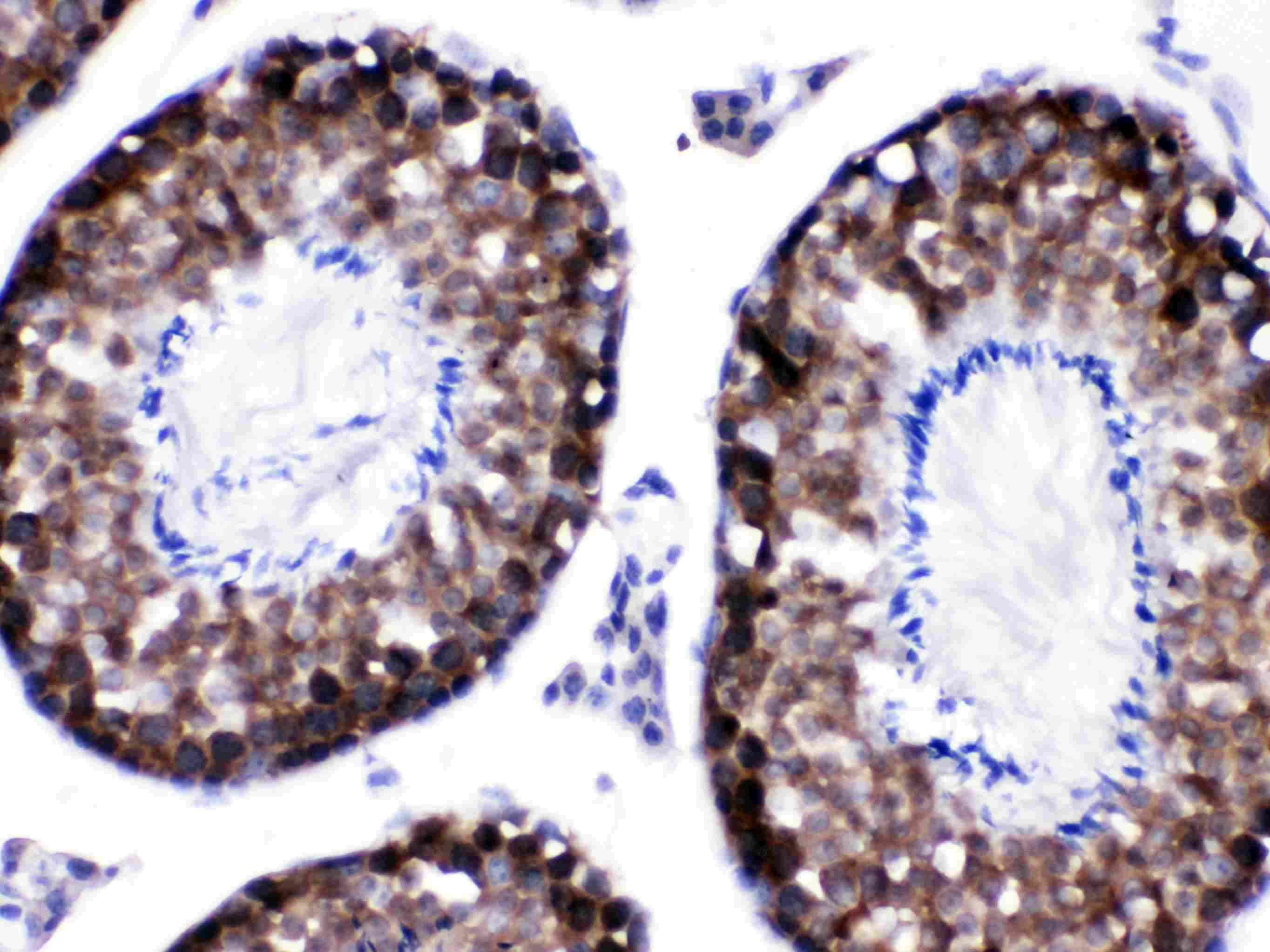 CACYBP Antibody