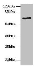 ALAS2 Antibody