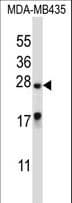 MEA1 Antibody (aa19-48)