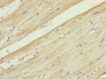 Polyclonal Rabbit anti-Human UQCC2 / MNF1 Antibody (IHC, WB)
