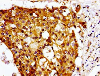 CHEMR23 / CMKLR1 Antibody
