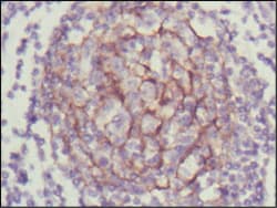 NTRK3 / TRKC Antibody (clone 7H6)