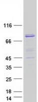 Human MTMR12 Protein (Recombinant Myc-DDK (Flag))